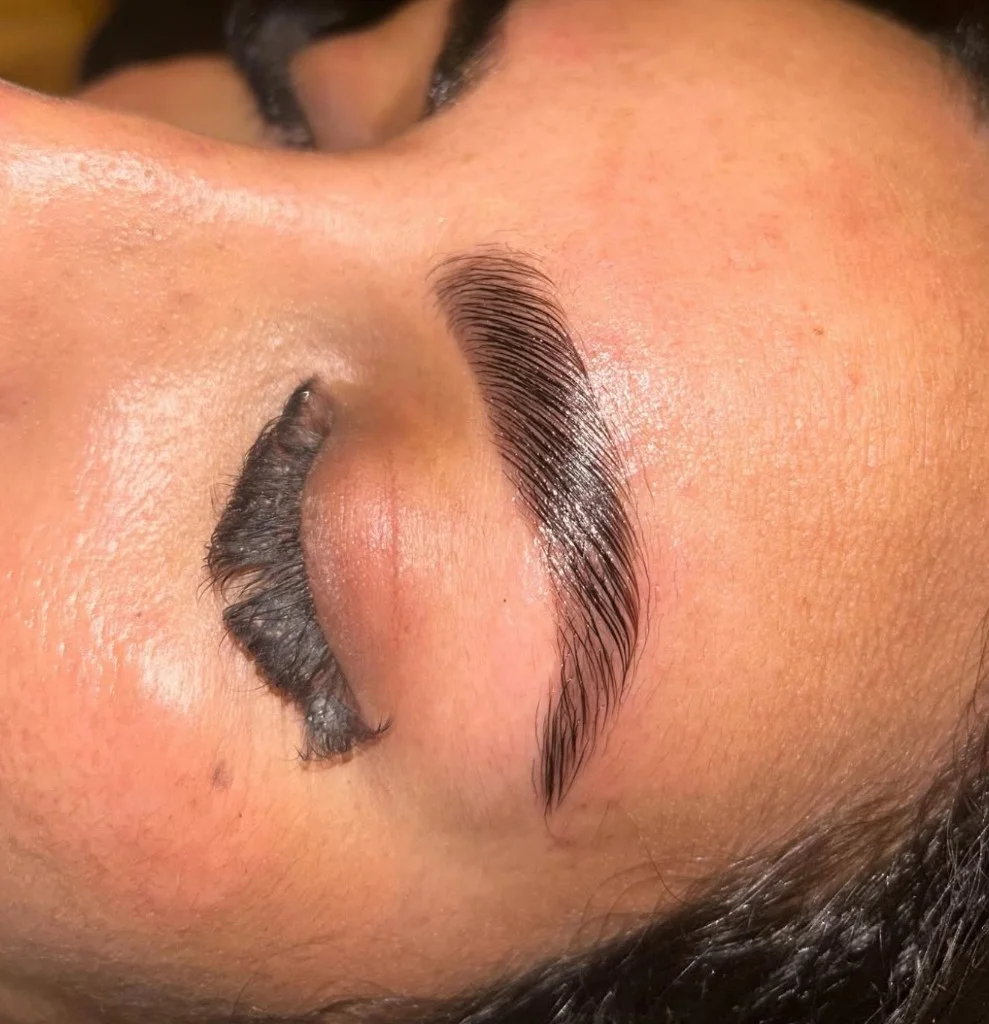 Après - Browlift exemple 4